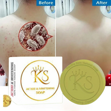 Load image into Gallery viewer, Kkongju Skin Acne and Whitening Soap
