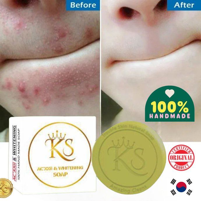 Kkongju Skin Acne and Whitening Soap